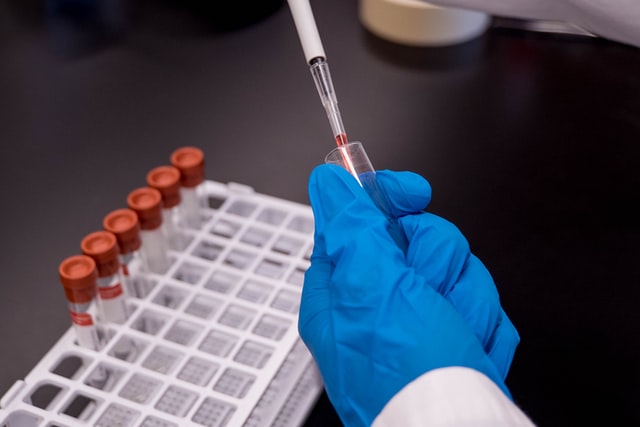 Diagnostyka boreliozy